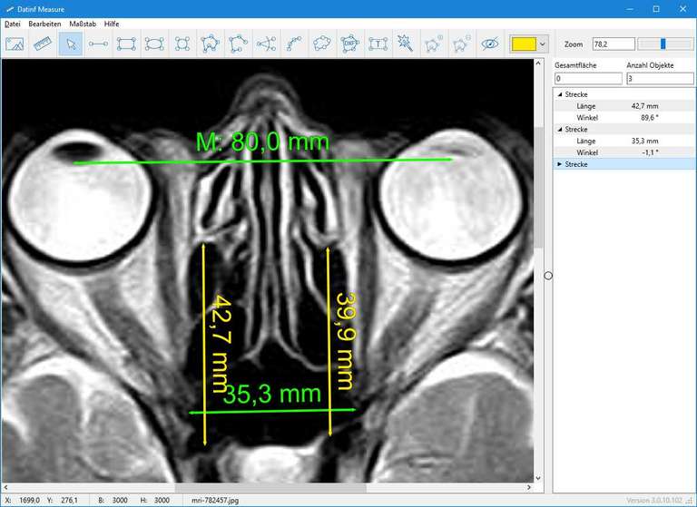 Screenshot Dat-inf Measure mit einem MRI-Bild